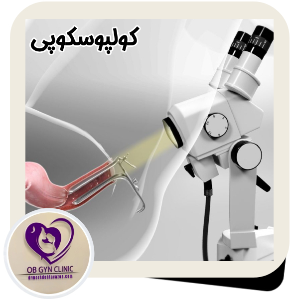 کولپوسکوپی - دکتر مژده تواضع https://drmozhdehtavazoe.com/