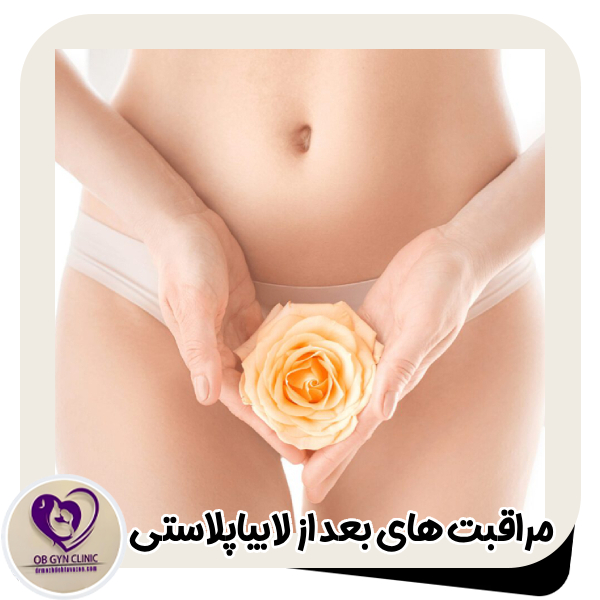مراقبت‌ های بعد از لابیاپلاستی - دکتر مژده تواضع https://drmozhdehtavazoe.com/