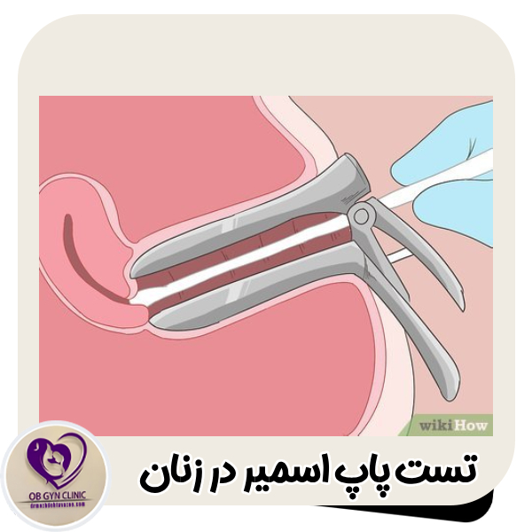 پاپ اسمیر - دکتر مژده تواضع https://drmozhdehtavazoe.com/