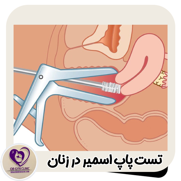 پاپ اسمیر - دکتر مژده تواضع https://drmozhdehtavazoe.com/