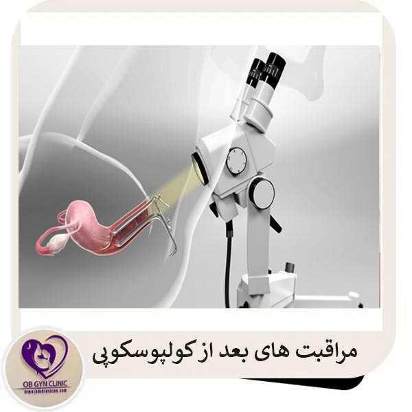 مراقبت های بعد از کولپوسکوپی _ دکتر مژده تواضع