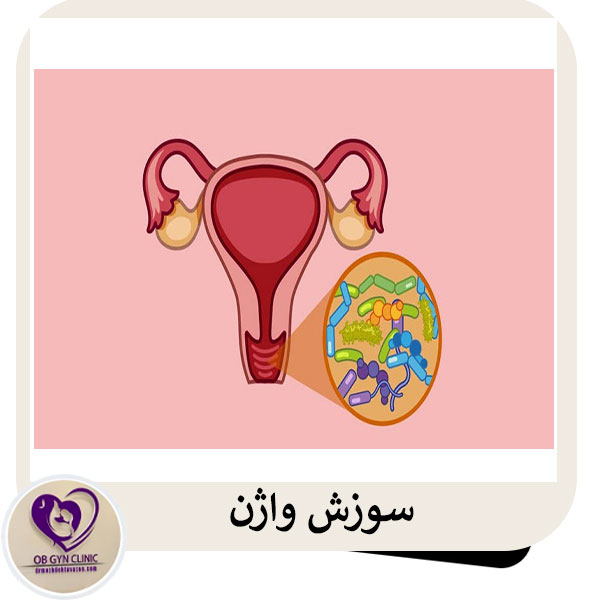 سوزش واژن _ دکتر مژده تواضع