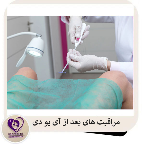 مراقبت های بعد از آی یو دی _ دکتر مژده تواضع